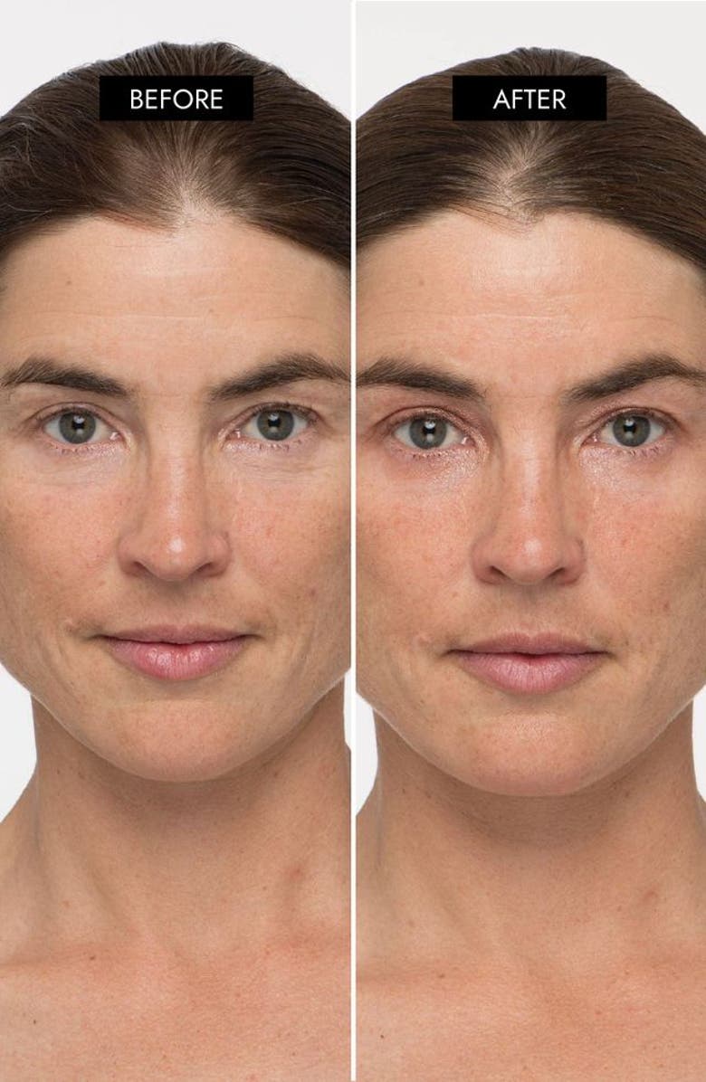 7e Wellness MyoLift TriWave Advanced Microcurrent Facial Device, Alternate, color, NO COLOR