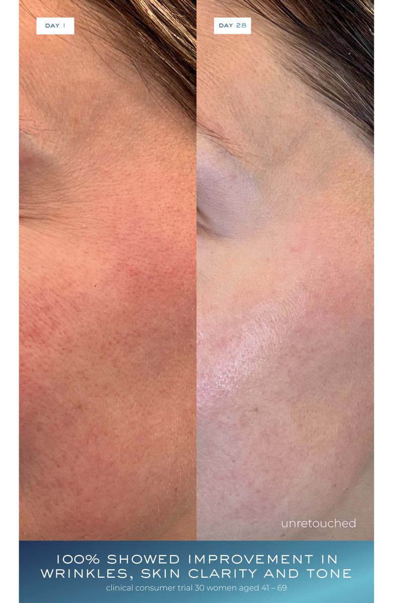 Element Eight O2 Niacinamide Eight Active Serum, Alternate, color,