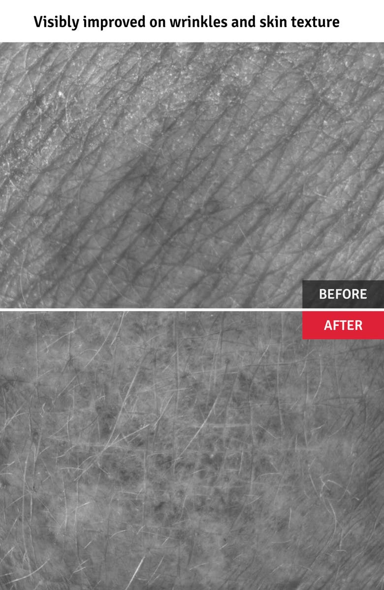 Vitabrid C12 Wrinkle Serum Professional Set, Alternate, color,