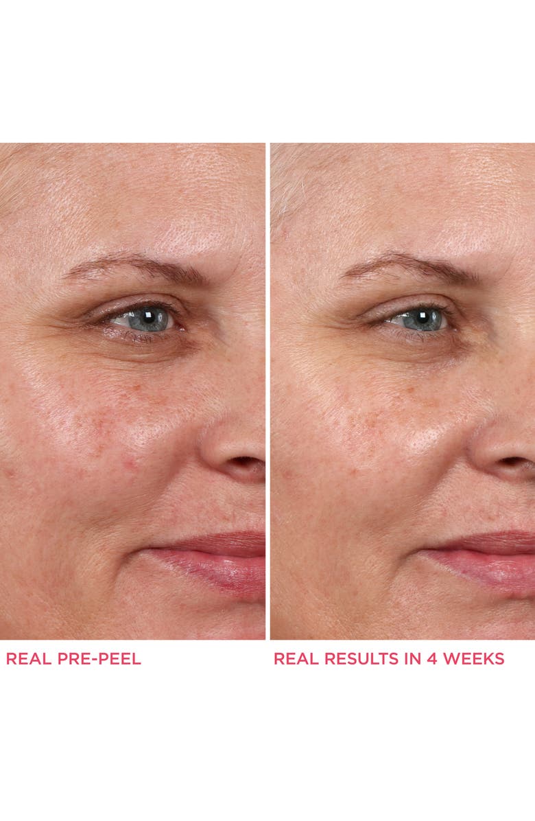 IT Cosmetics Hello Results Baby-Smooth Glycolic Acid Peel + Caring Oil, Alternate, color, 