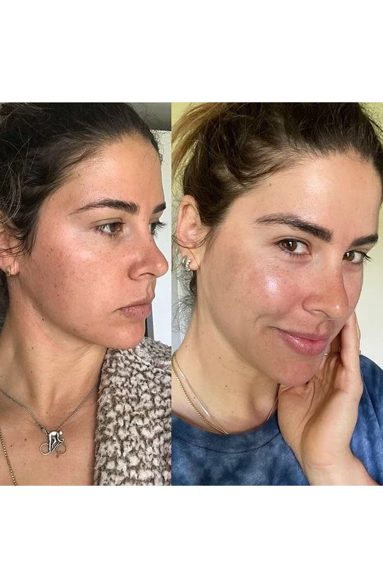 Dr. Devgan Scientific Beauty Hyaluronic Niacin Panthenol Serum, Alternate, color, NO COLOR