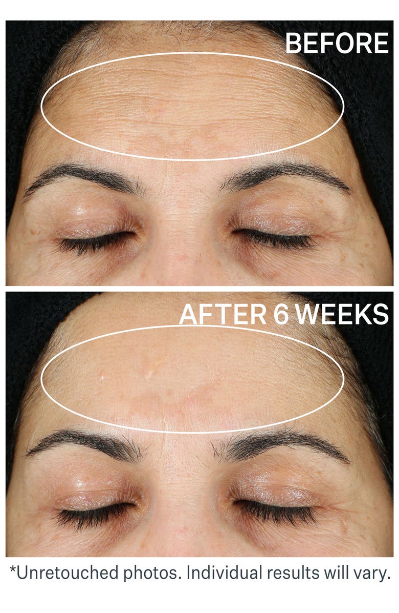 StriVectin<sup>®</sup> Super-C Brighten & Correct Serum, Alternate, color, 