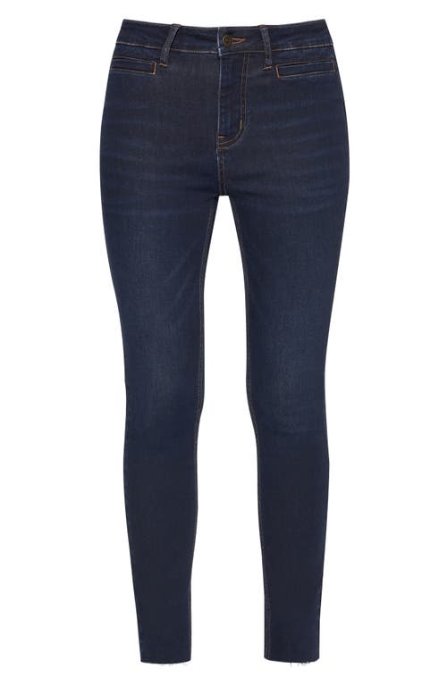 Bayeas Yoyo Skinny Jeans