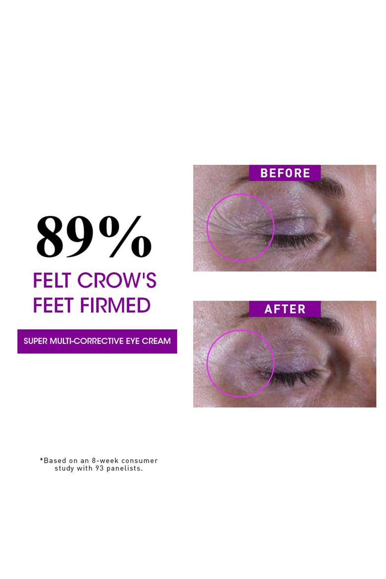 Super Multi-Correctors for Face & Eye Set $105 Value, Alternate, color, NO COLOR