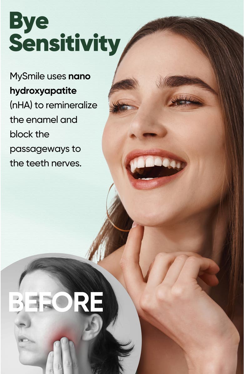 MySmile Daily Cleaning Essentials Bundle, Alternate, color, Blue