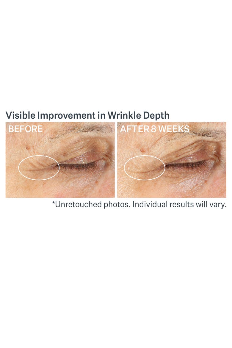 Advanced Retinol Multi-Correct Eye Cream, Alternate, color, NO COLOR