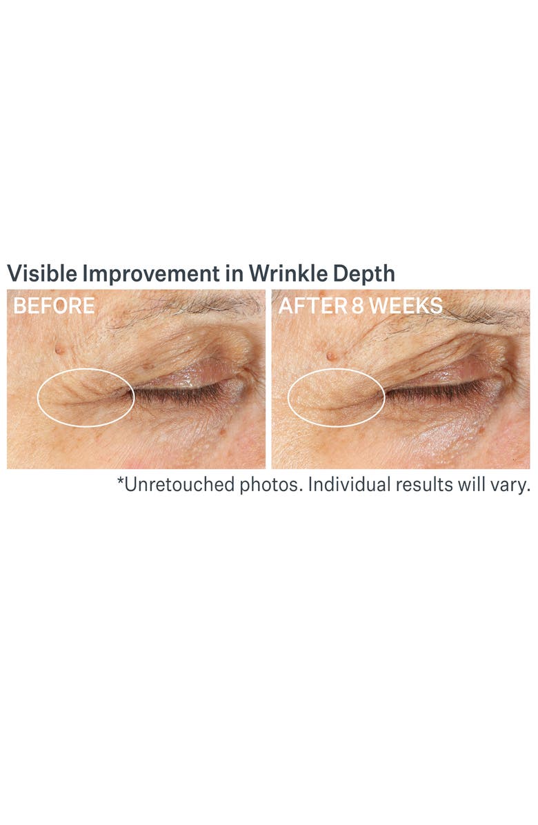 StriVectin<sup>®</sup> Advanced Retinol Multi-Correct Eye Cream, Alternate, color,