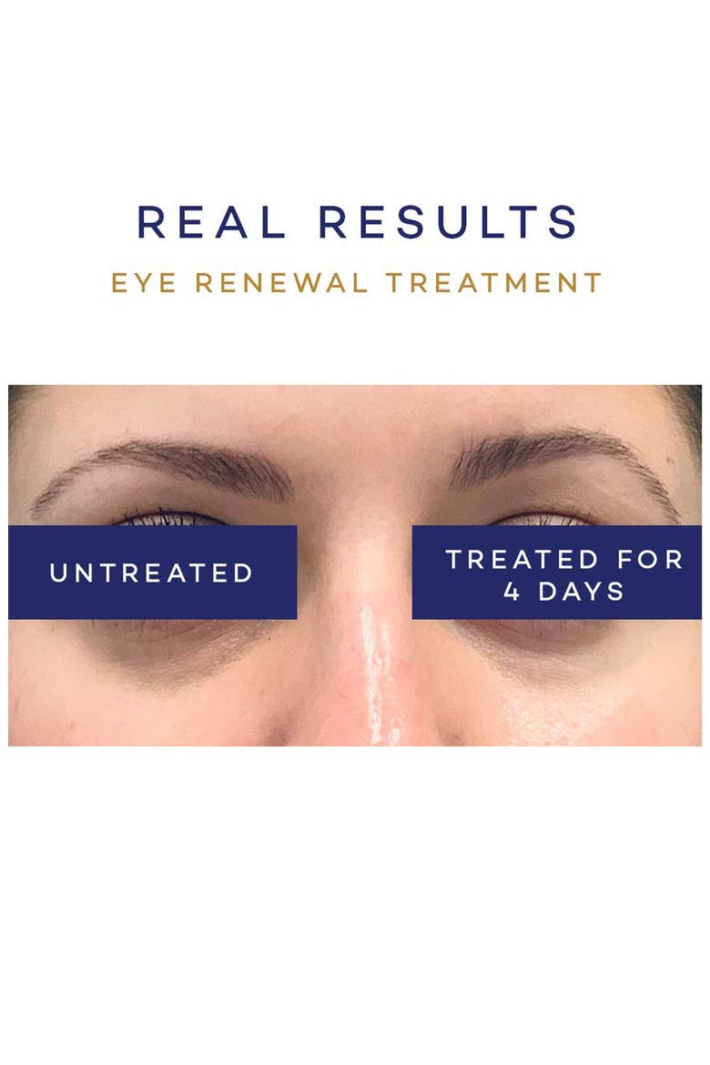 Eye Renewal Treatment, Alternate, color, NO COLOR