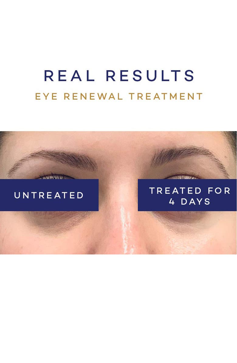 PAUSE Eye Renewal Treatment, Alternate, color, 