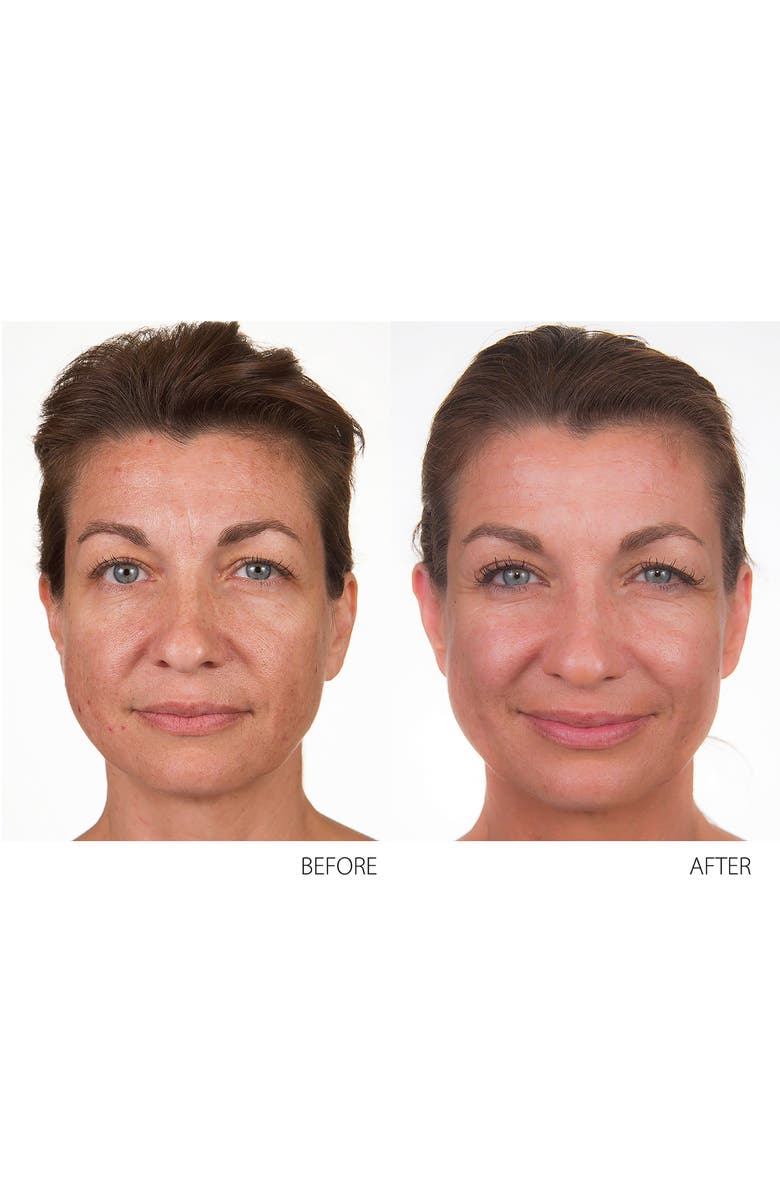 Conture Kinetic Skin Toning System, Alternate, color, 