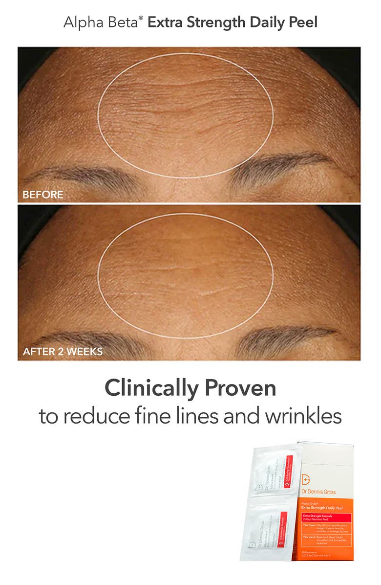 Dr. Dennis Gross Skincare The Peel Vault Set $245 Value, Alternate, color, 