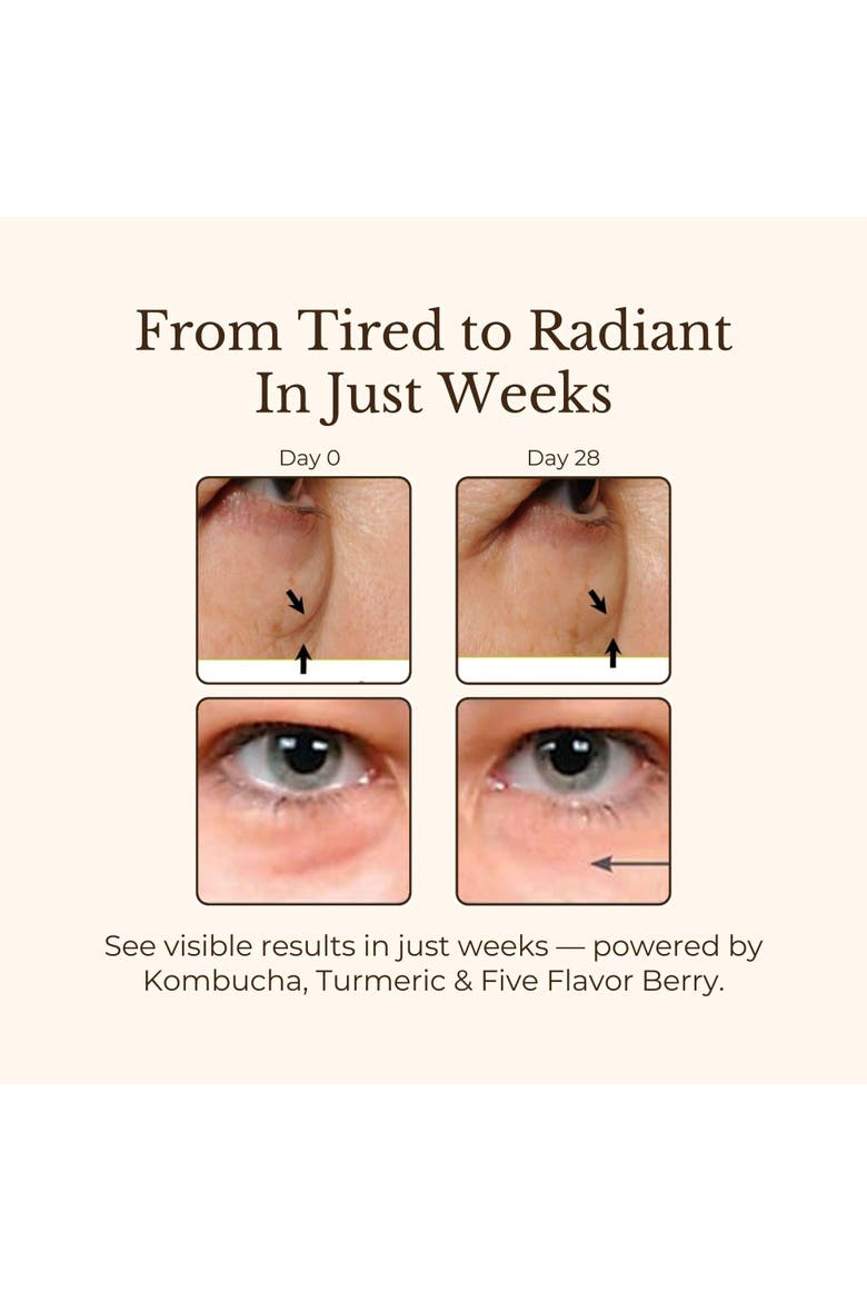 Miracle Tea Eye Crème, Alternate, color, None