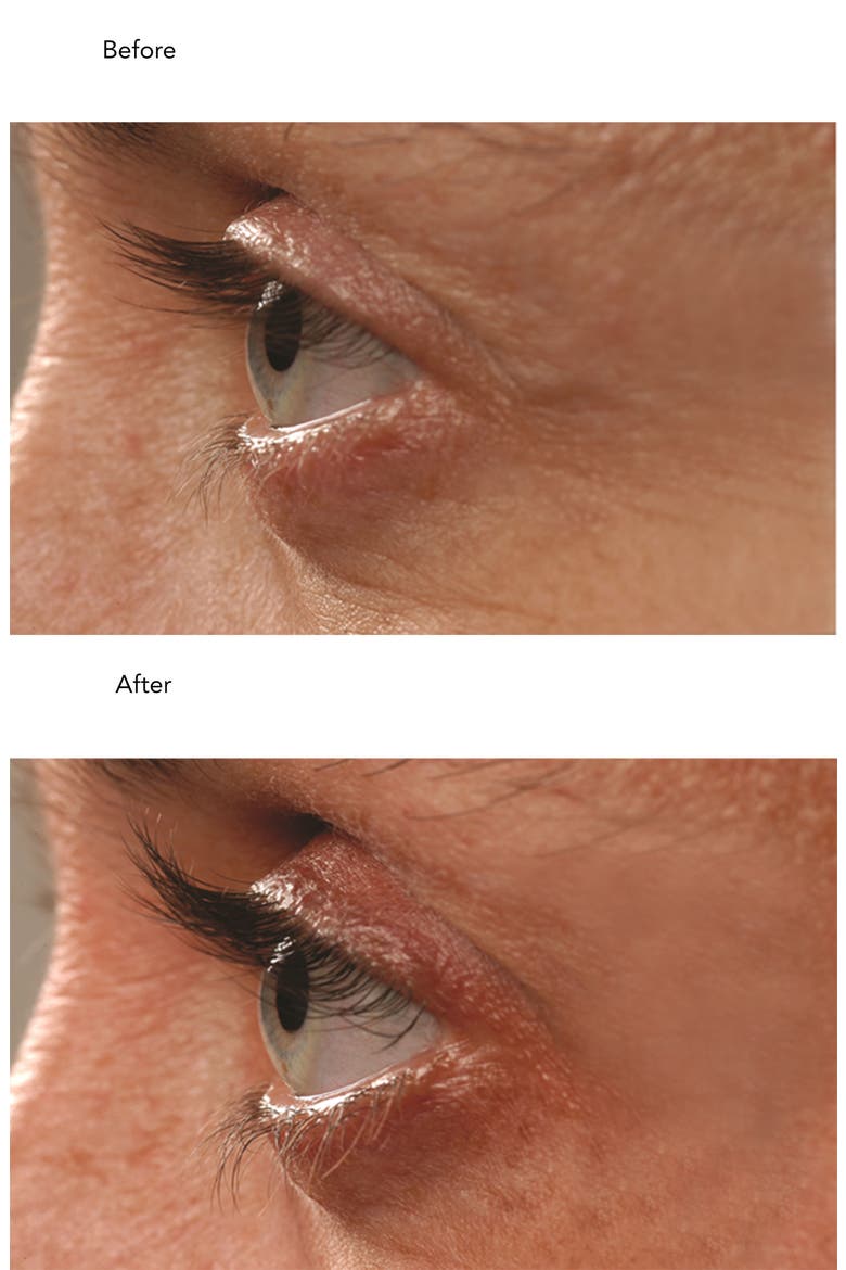 Lash Enhancing Serum Duo, Alternate, color, NO COLOR