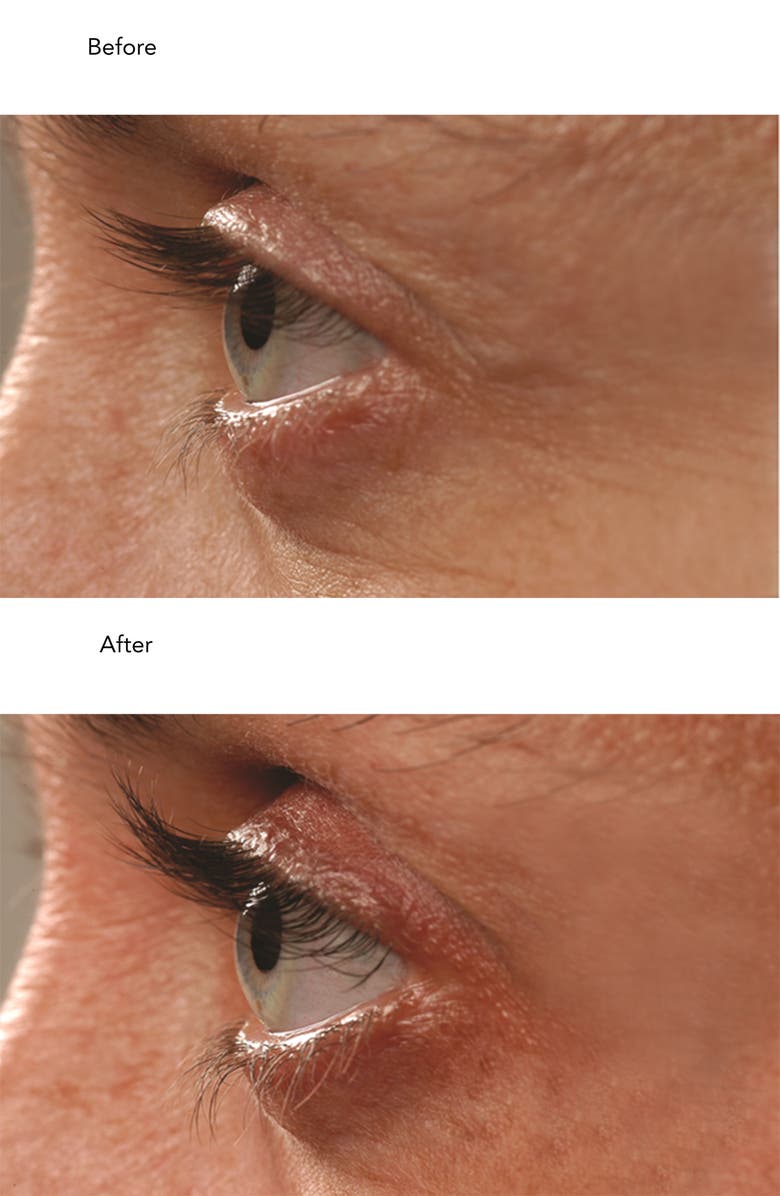 neuLASH<sup>®</sup> Lash Enhancing Serum Duo, Alternate, color,