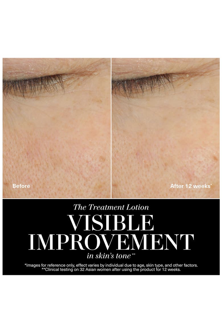 The New Treatment Lotion for Hydration & Anti-Aging, Alternate, color, NO COLOR