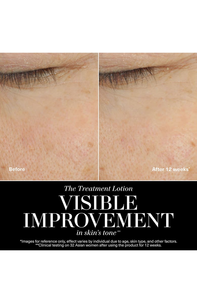 The New Treatment Lotion