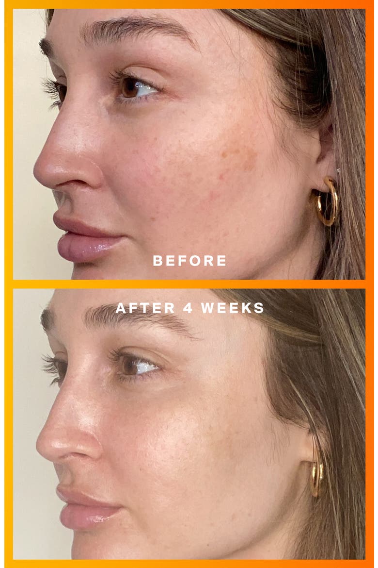 Daily Dose Vitamin C + SPF 40 Serum, Alternate, color, NO COLOR