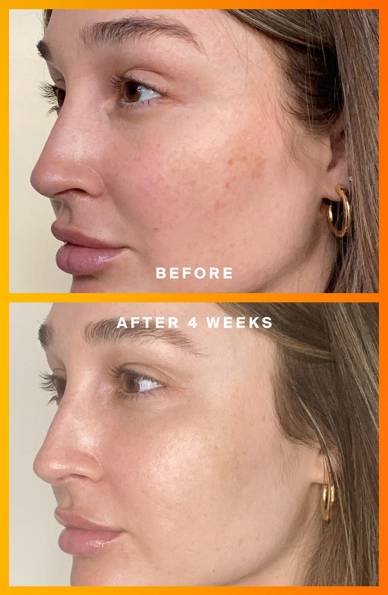 Supergoop!<sup>®</sup> Daily Dose Vitamin C + SPF 40 Serum, Alternate, color, 