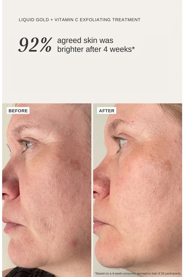 Liquid Gold™ Vitamin C Exfoliating Treatment with 5% Glycolic Acid, Alternate, color, NO COLOR