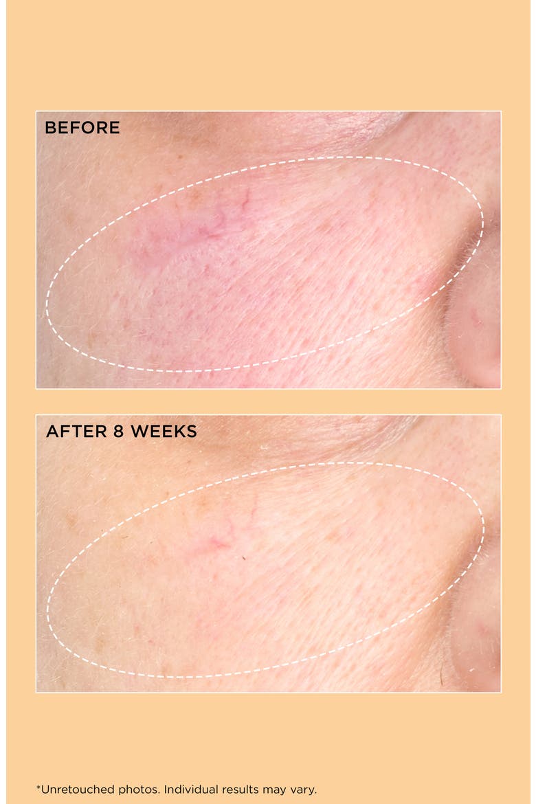 Neuropeptide Pro-Strength Firming Moisturizer, Alternate, color, NO COLOR