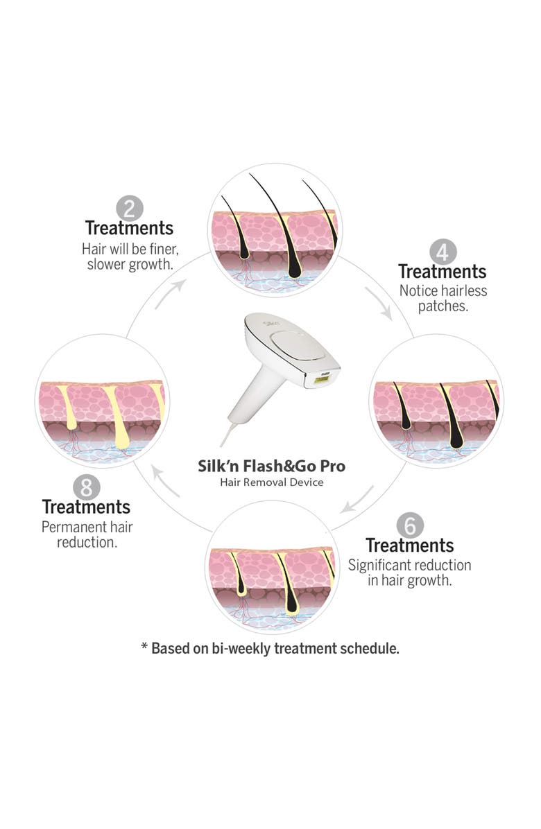 Silk'n BellaFlash Pro Hair Removal Device, Alternate, color,