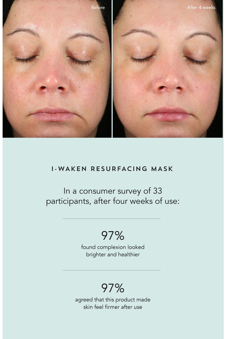 I-Waken Resurfacing Mask, Alternate, color, NO COLOR