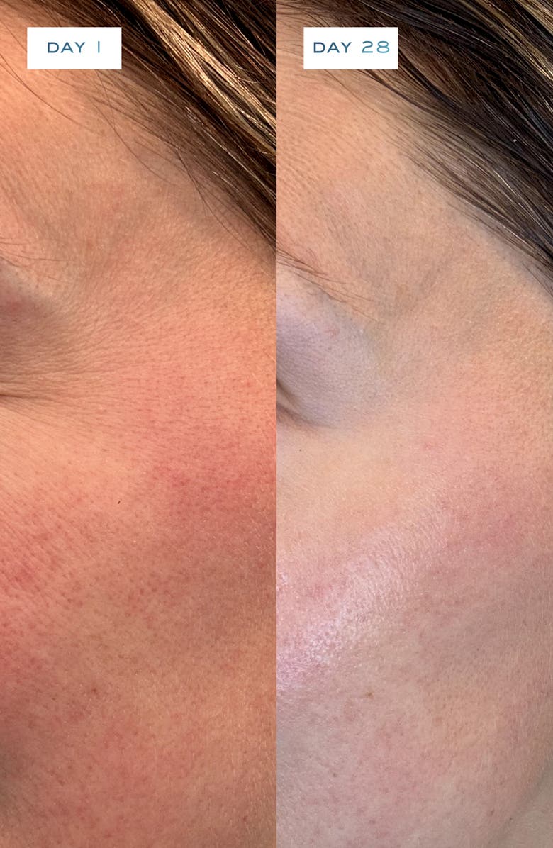 Element Eight O2 Eight Active Full Face Routine Skin Care Set (Limited Edition) $775 Value, Alternate, color,