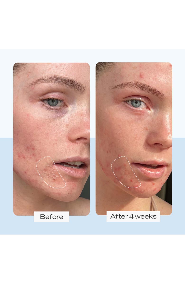 First Aid Beauty Hoty Totsy Skin Care Gift Set $30 Value, Alternate, color, 