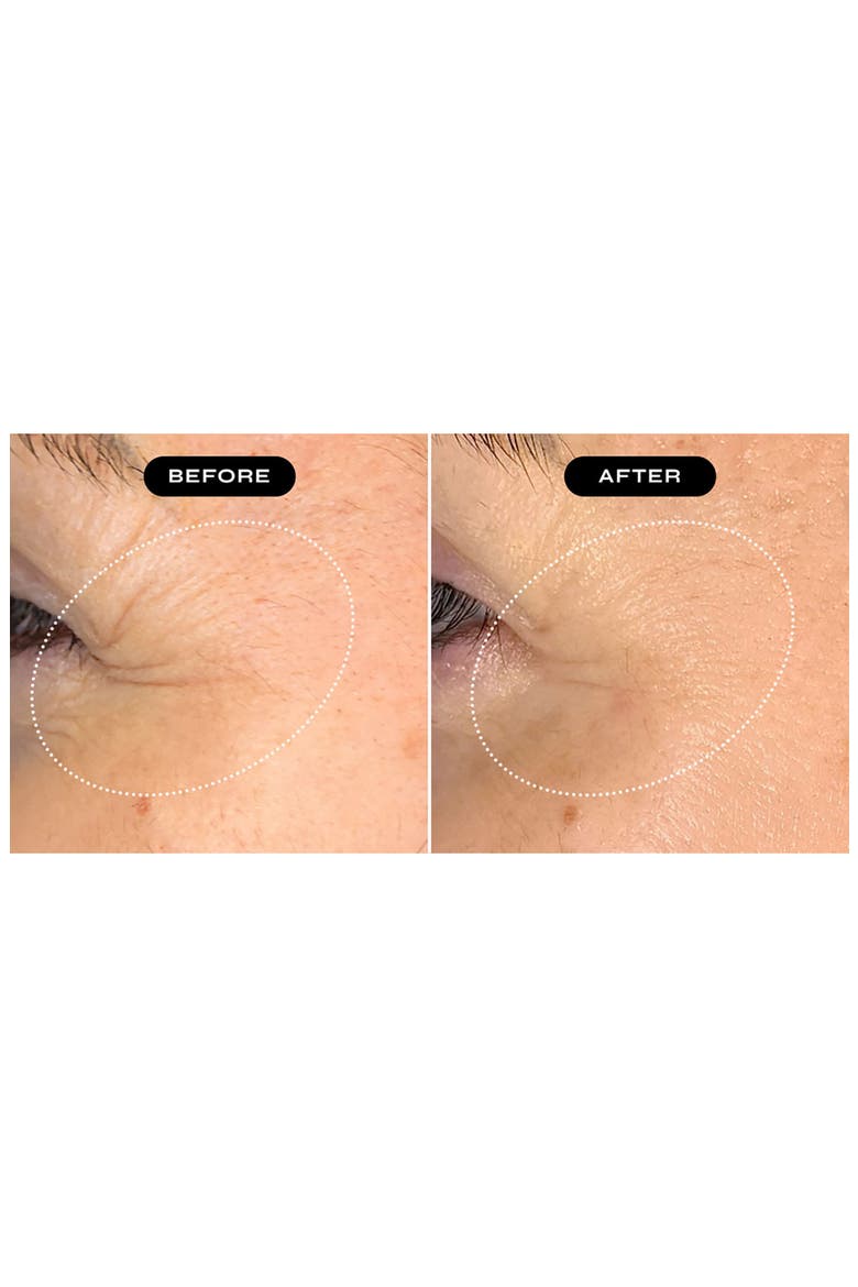 Biopeptide Growth Factor Eye Therapy Serum, Alternate, color, NO COLOR