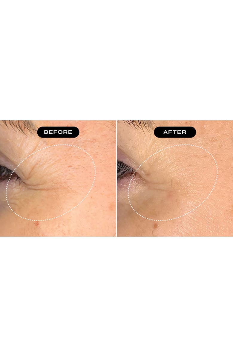 NakedBeauty MD Biopeptide Growth Factor Eye Therapy Serum, Alternate, color, 