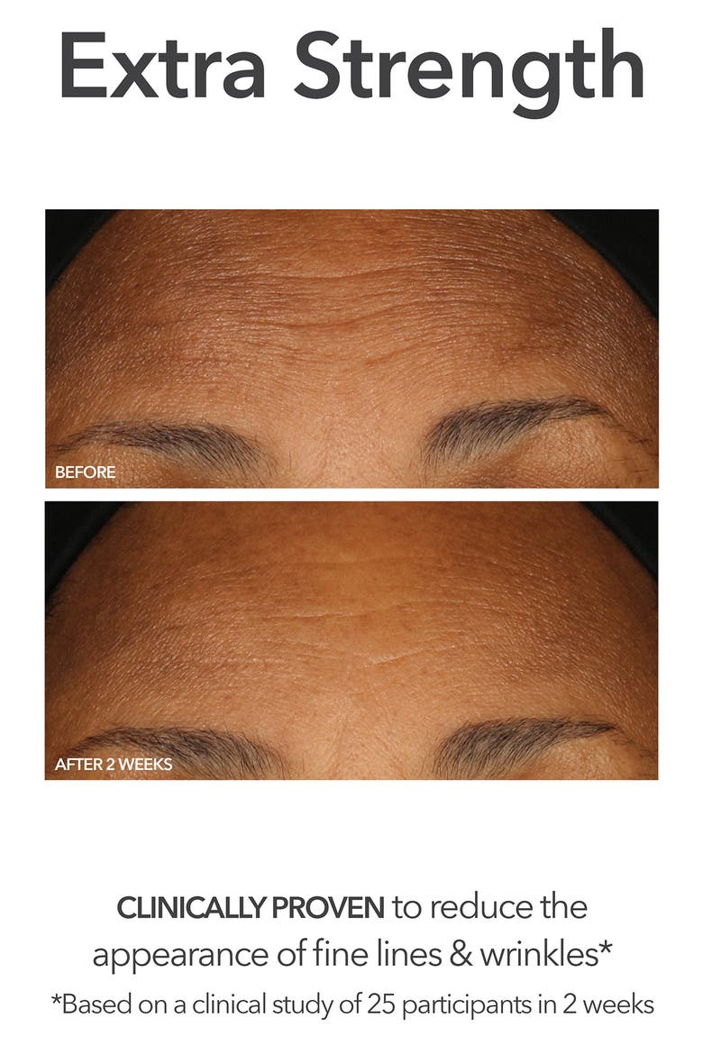 Glow, Brighten & Smooth Set $245 Value, Alternate, color, NO COLORDNU