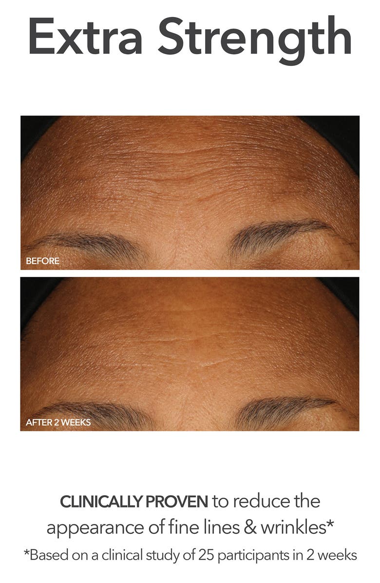 Dr. Dennis Gross Skincare Glow, Brighten & Smooth Set $245 Value, Alternate, color,