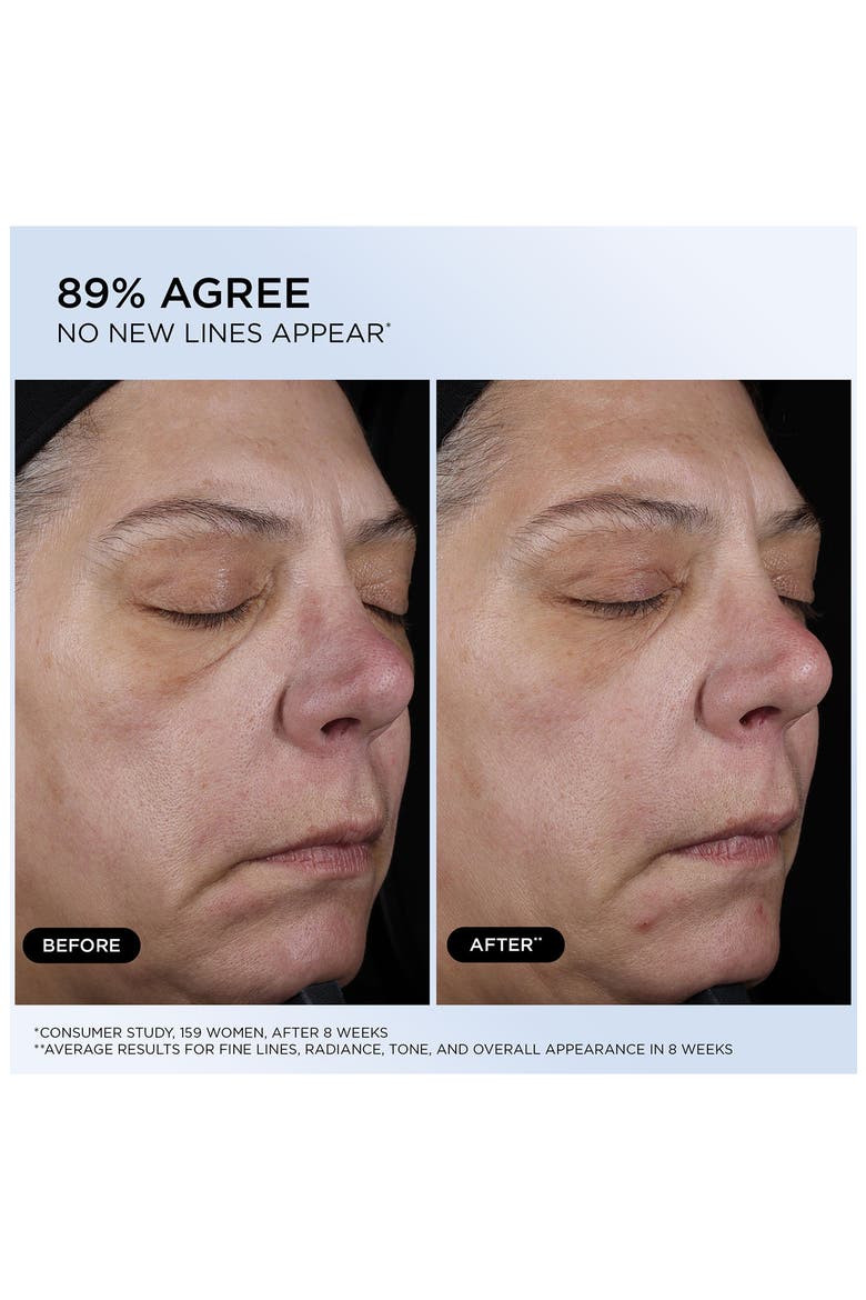 Génifique Ultimate Recovery Serum Refill, Alternate, color, NO COLOR