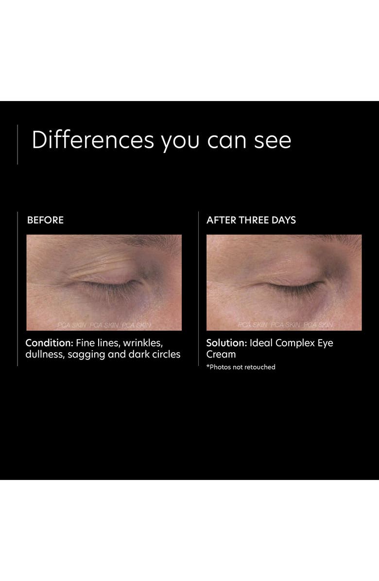 PCA Skin Ideal Complex Restorative Eye Cream, Alternate, color,