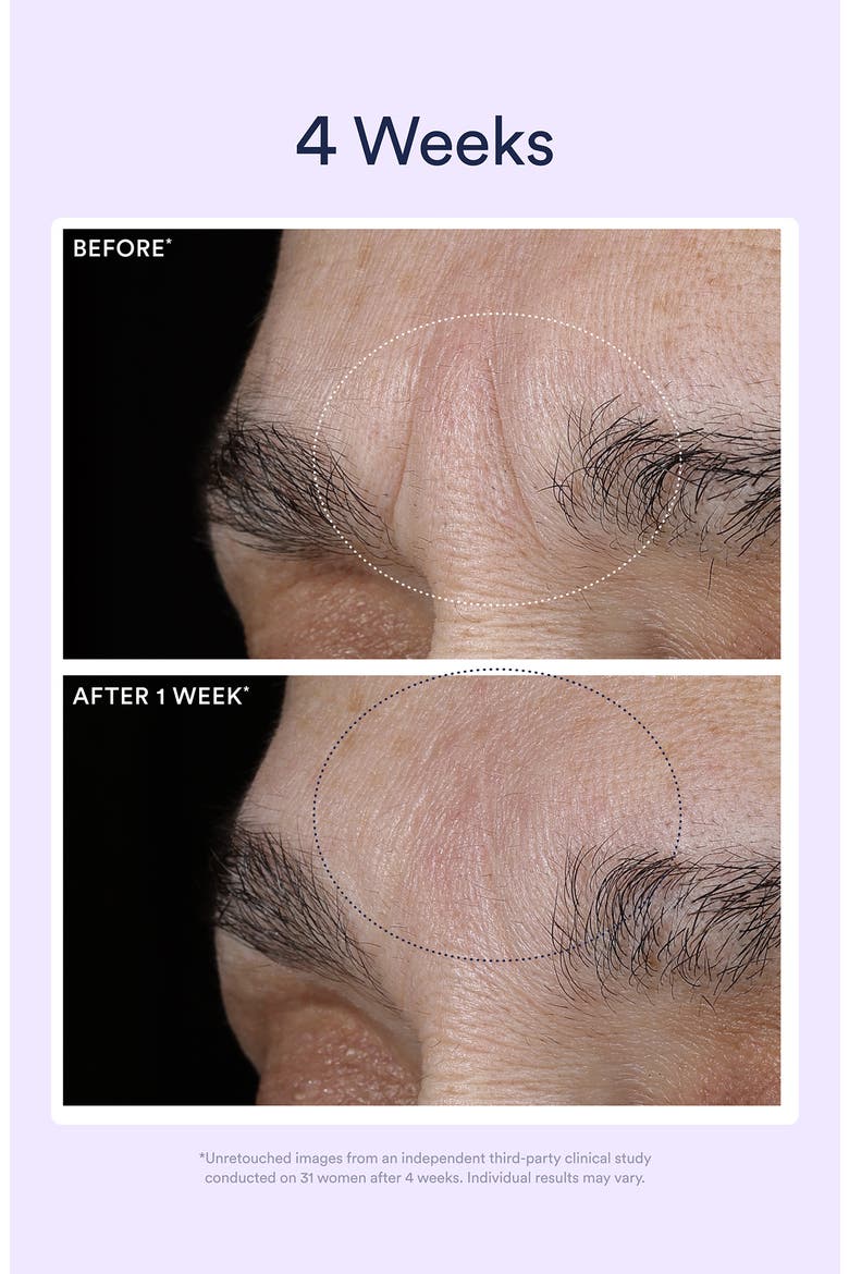 Dream Night Serum with Bio-Retinol, Alternate, color, NO COLOR