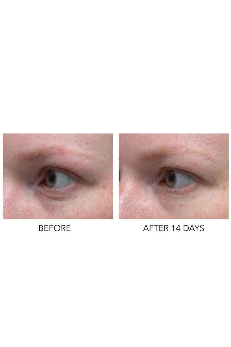 Hyaluronic Marine Dew It Right Eye Gel, Alternate, color, NO COLOR