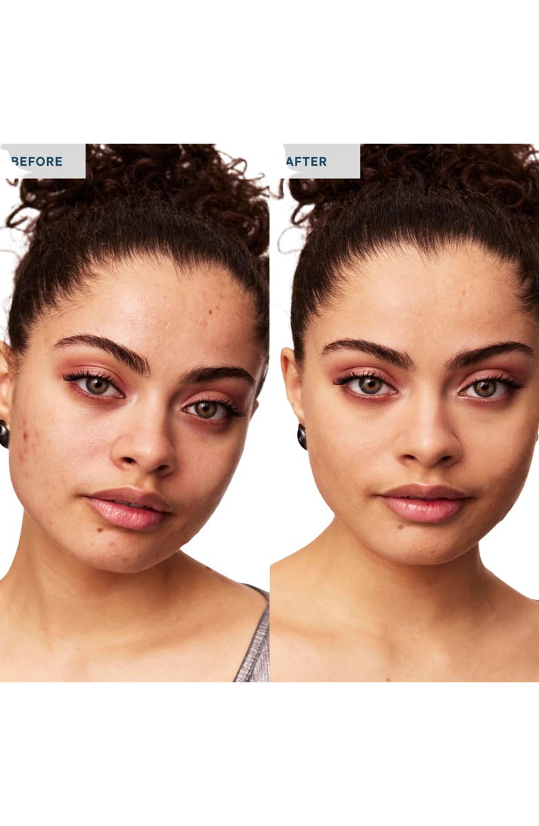 SPATCH Invisble Spot Fix, Alternate, color, 