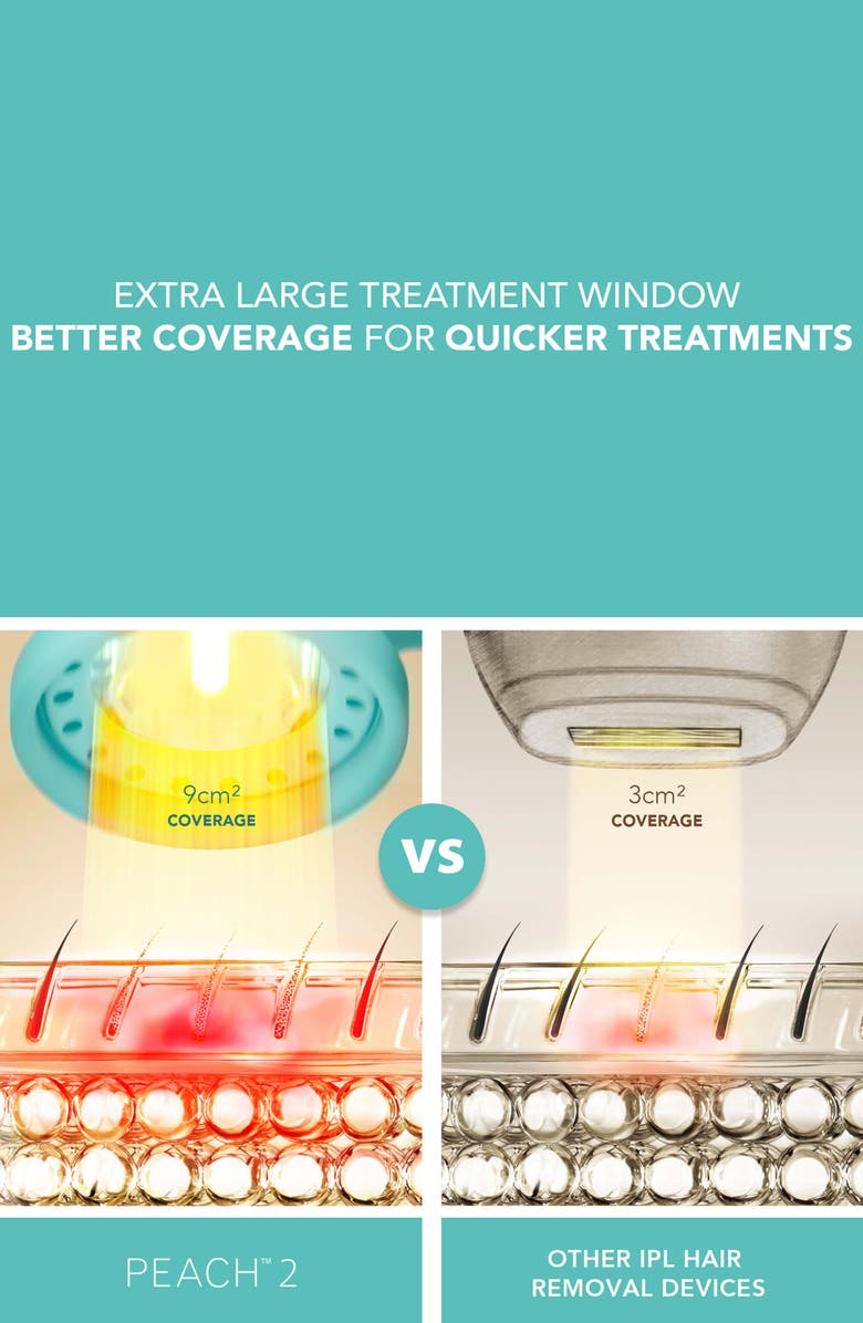 FOREO PEACH<sup>™</sup> 2 IPL Hair Removal Device & Prep Gel Bundle, Alternate, color, 