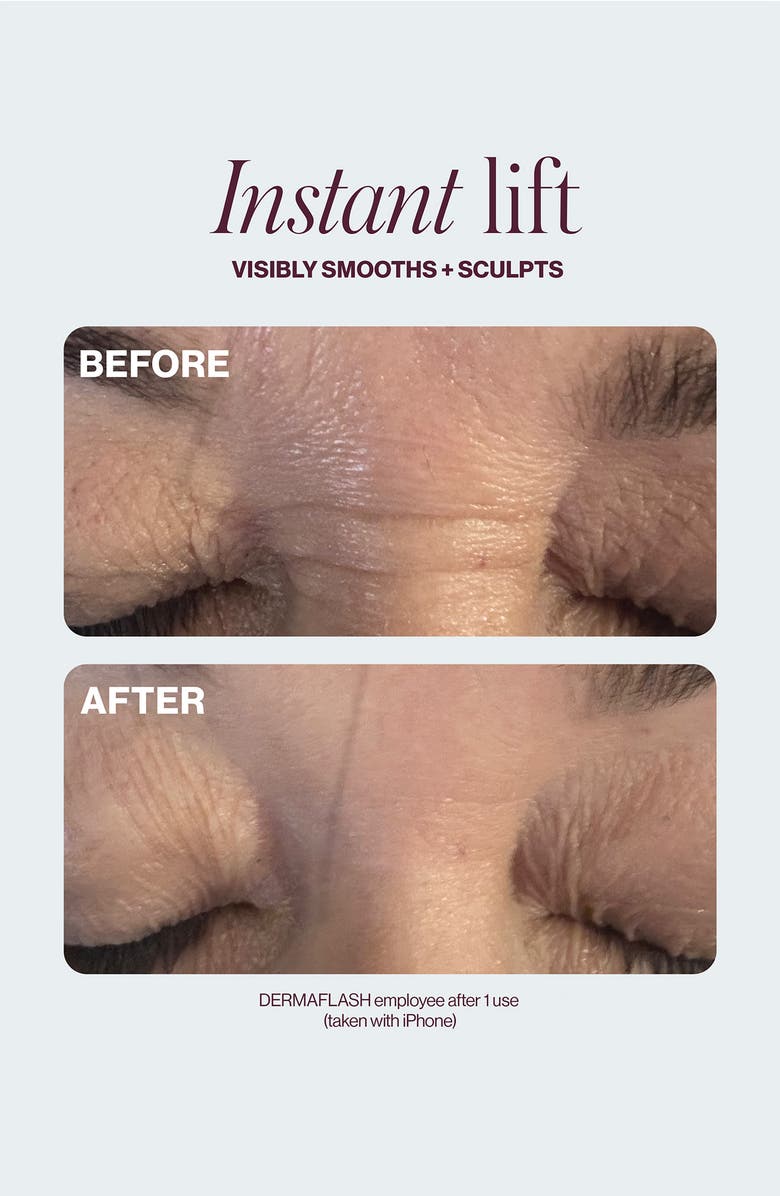 DERMAFLASH <sup>®</sup> Cool Sonic Depuffing Tool, Alternate, color, 