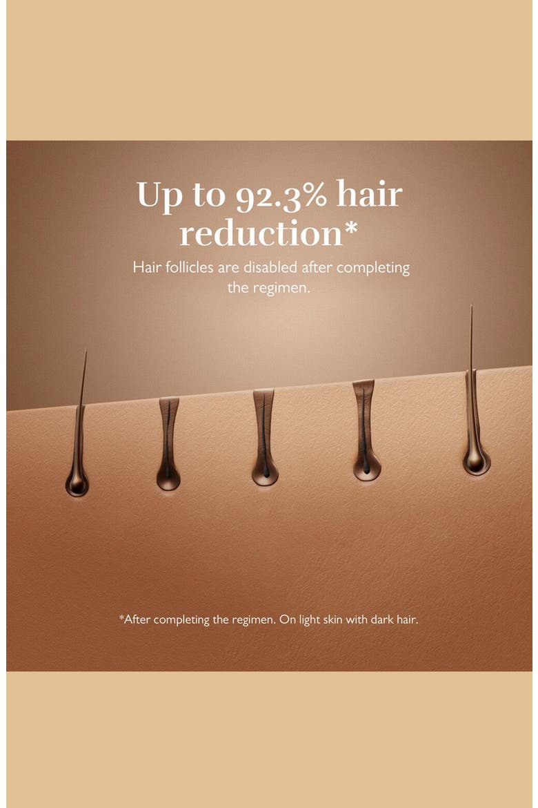 7 Hair Removal Device, Alternate, color, BLACK