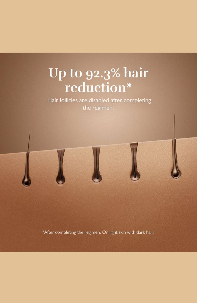 Silk'n 7 Hair Removal Device, Alternate, color, Black