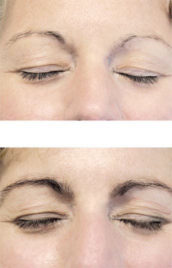 neuBROW<sup>®</sup> Brow Serum Set $170 Value