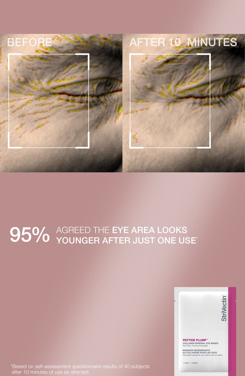 StriVectin<sup>®</sup> Skin Minis Skin Care Set $78 Value, Alternate, color, 