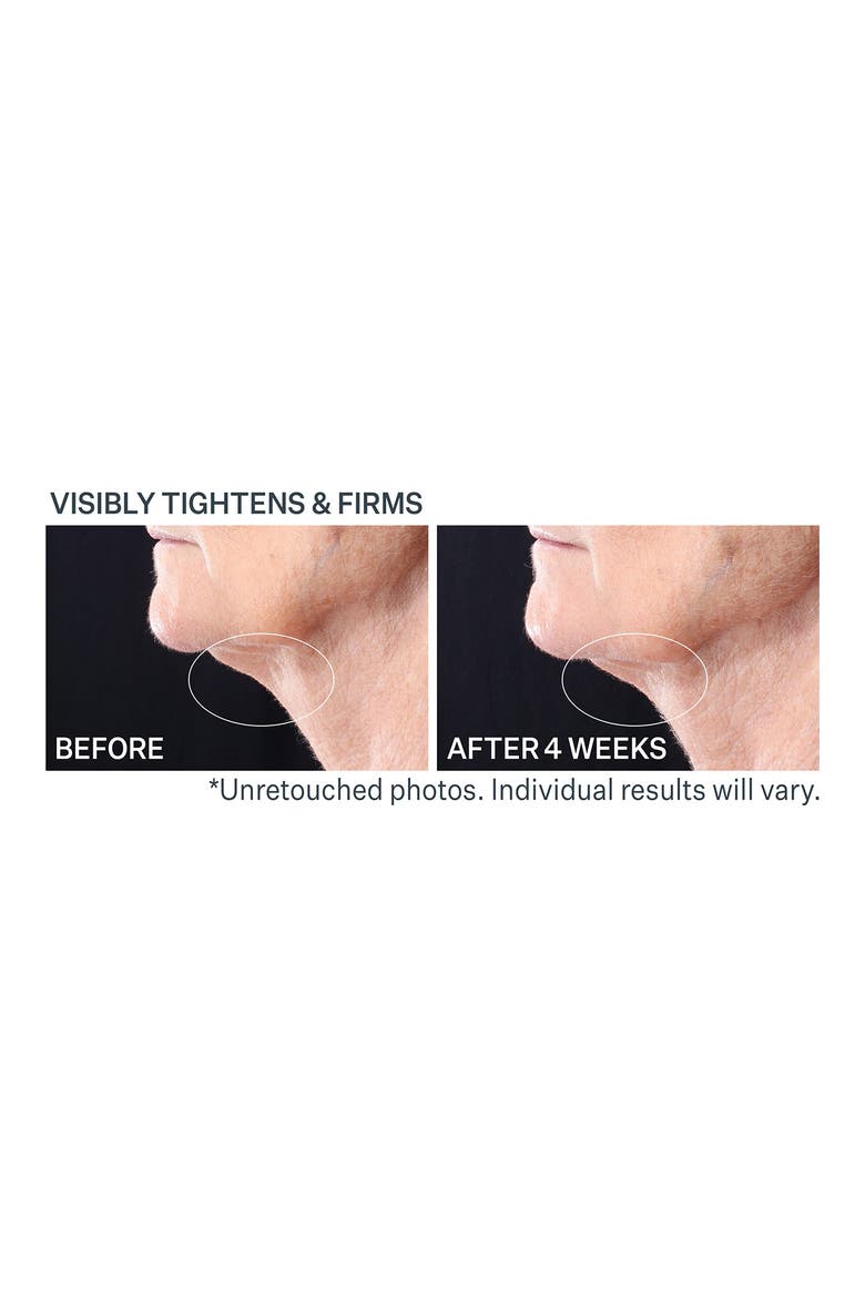 Strivectin Peptight Tightening Serum Roller, Alternate, color, NO COLOR