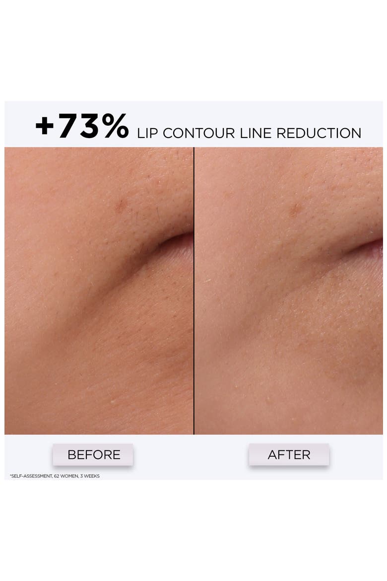 Génifique Repair Shot Multi-Wrinkle Corrector, Alternate, color, NO COLOR
