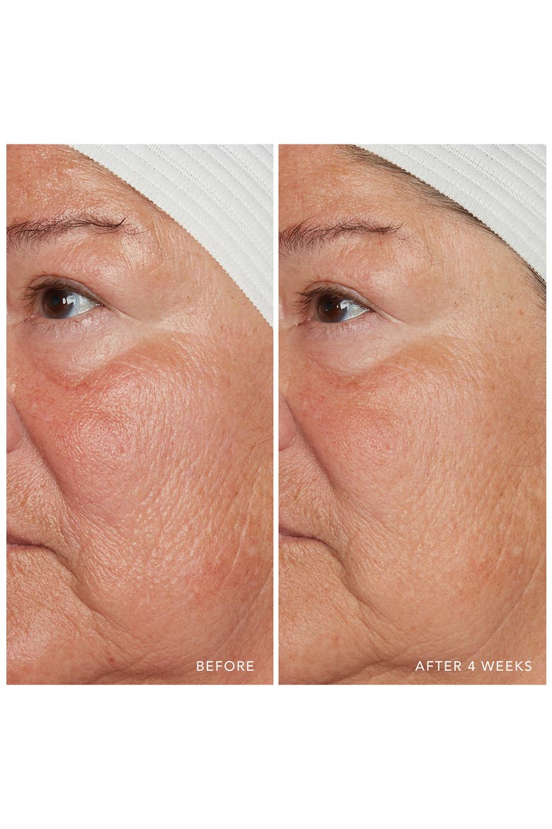 Redness Relief Intense with Manuka Honey, Alternate, color, NO COLOR