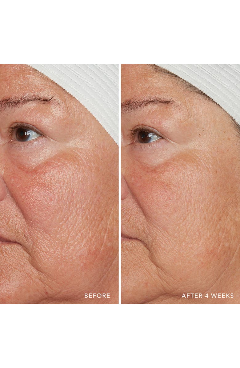 LANCER Skincare Redness Relief Intense with Manuka Honey, Alternate, color, 