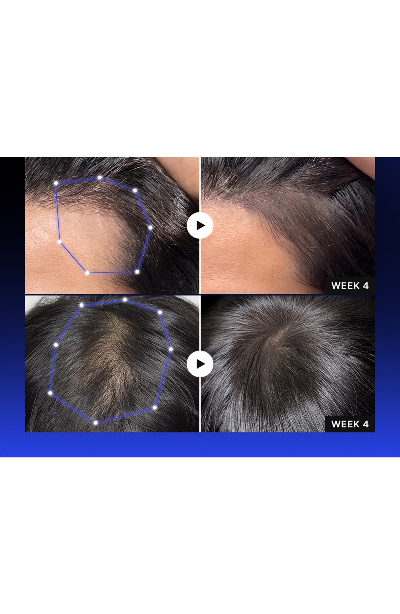 Lilyeve Grow:Turn Exosome Brush Ampoule Prime (Women) | Nordstrom