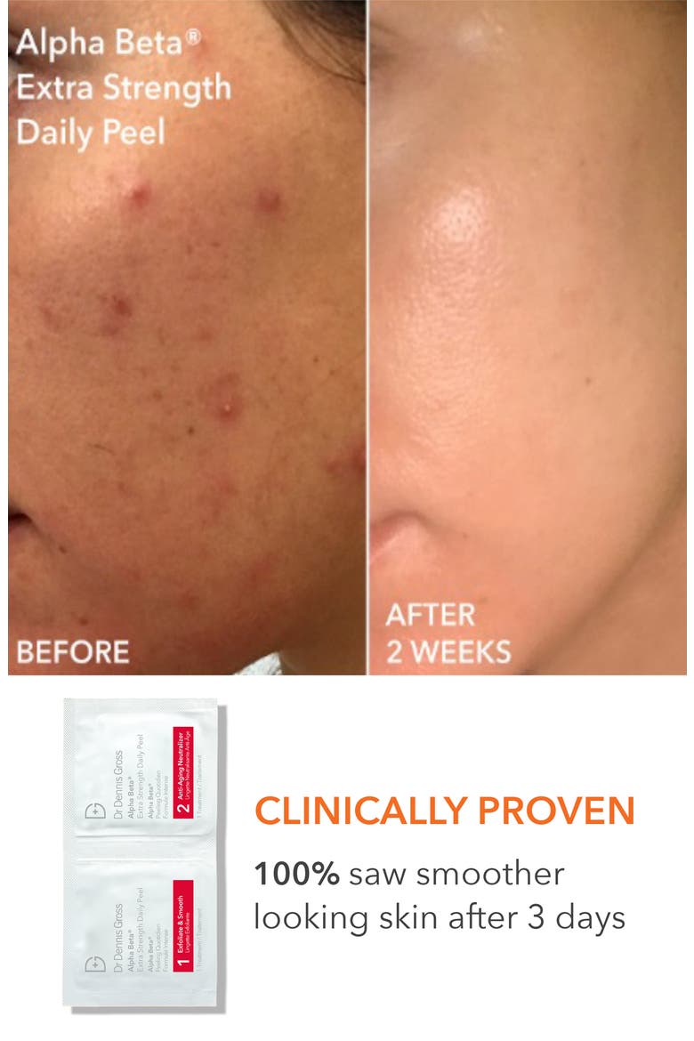Collagen Boosting Essentials Set $641 Value, Alternate, color, NO COLOR