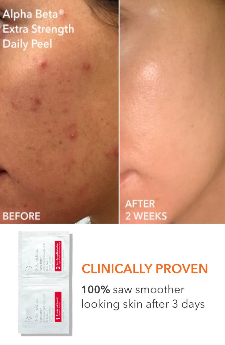 Dr. Dennis Gross Skincare Collagen Boosting Essentials Set $641 Value, Alternate, color,